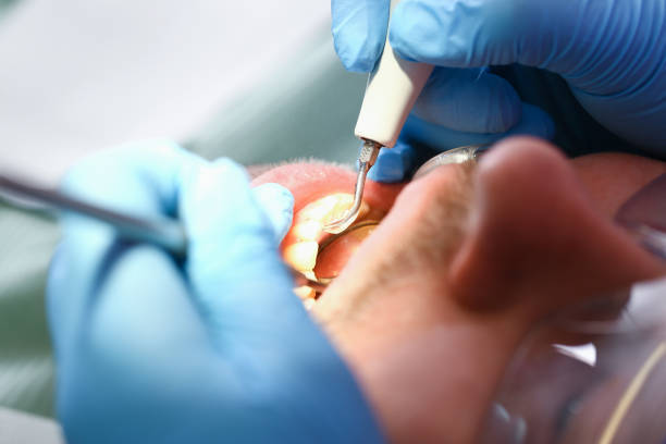 Best Cosmetic Emergency Dentistry in Kenworth, IL